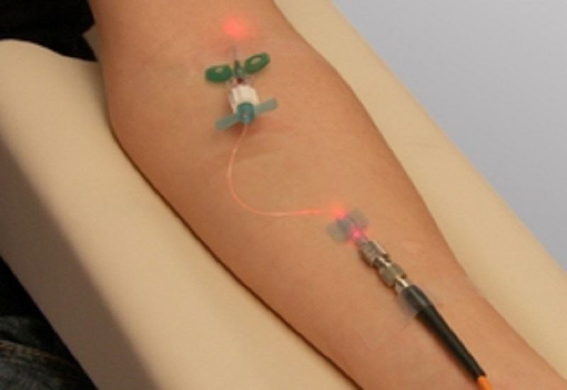 Laser Terapia Fotodinamica 